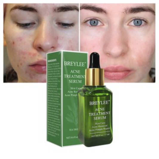 BREYLEE Acne Treatment Serum and Acne Pimple Scar Remover