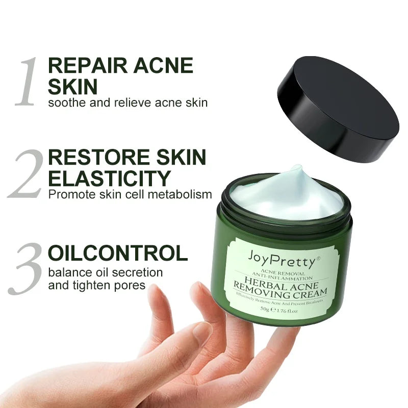 JOYPRETTY Herbal Acne Removing Cream