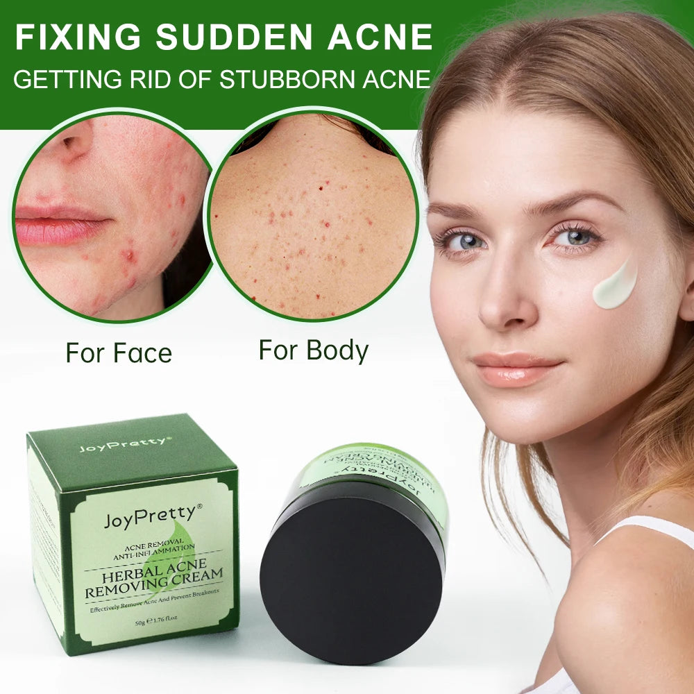 JOYPRETTY Herbal Acne Removing Cream