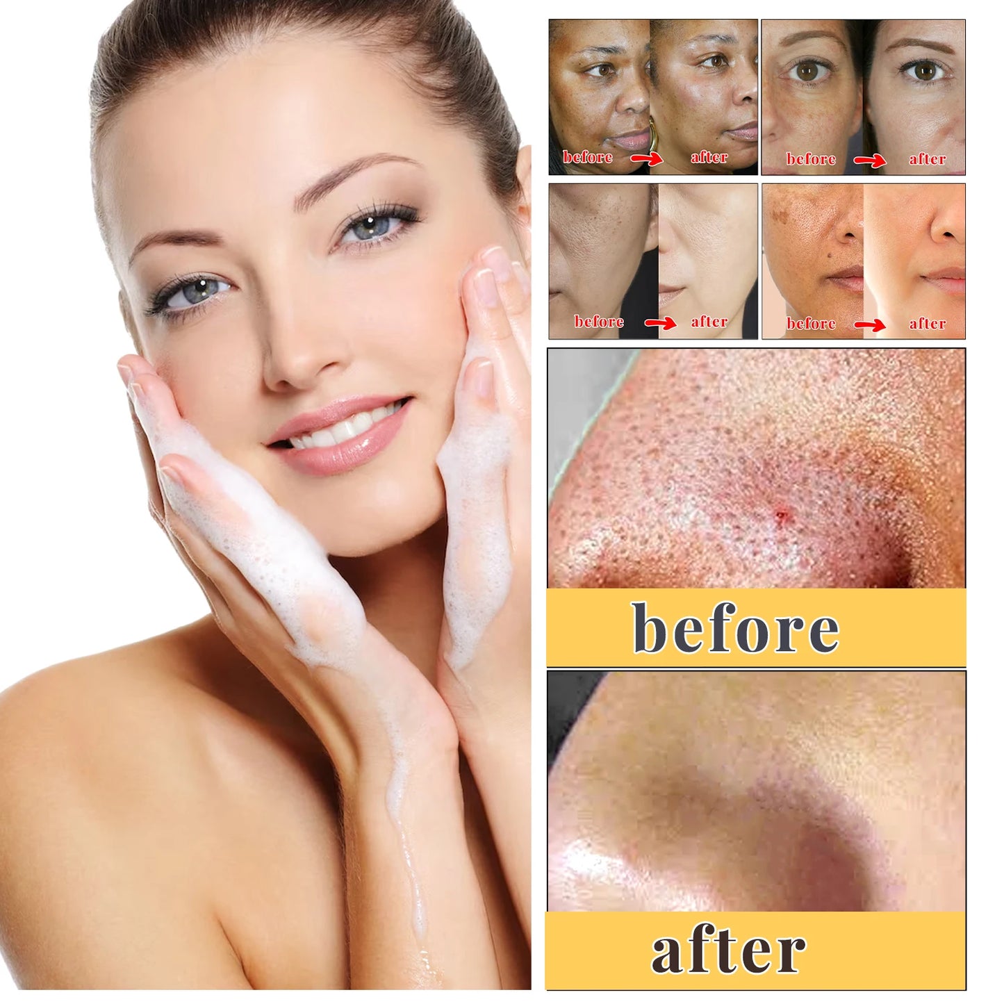 Kojic Acid Skin Care Set