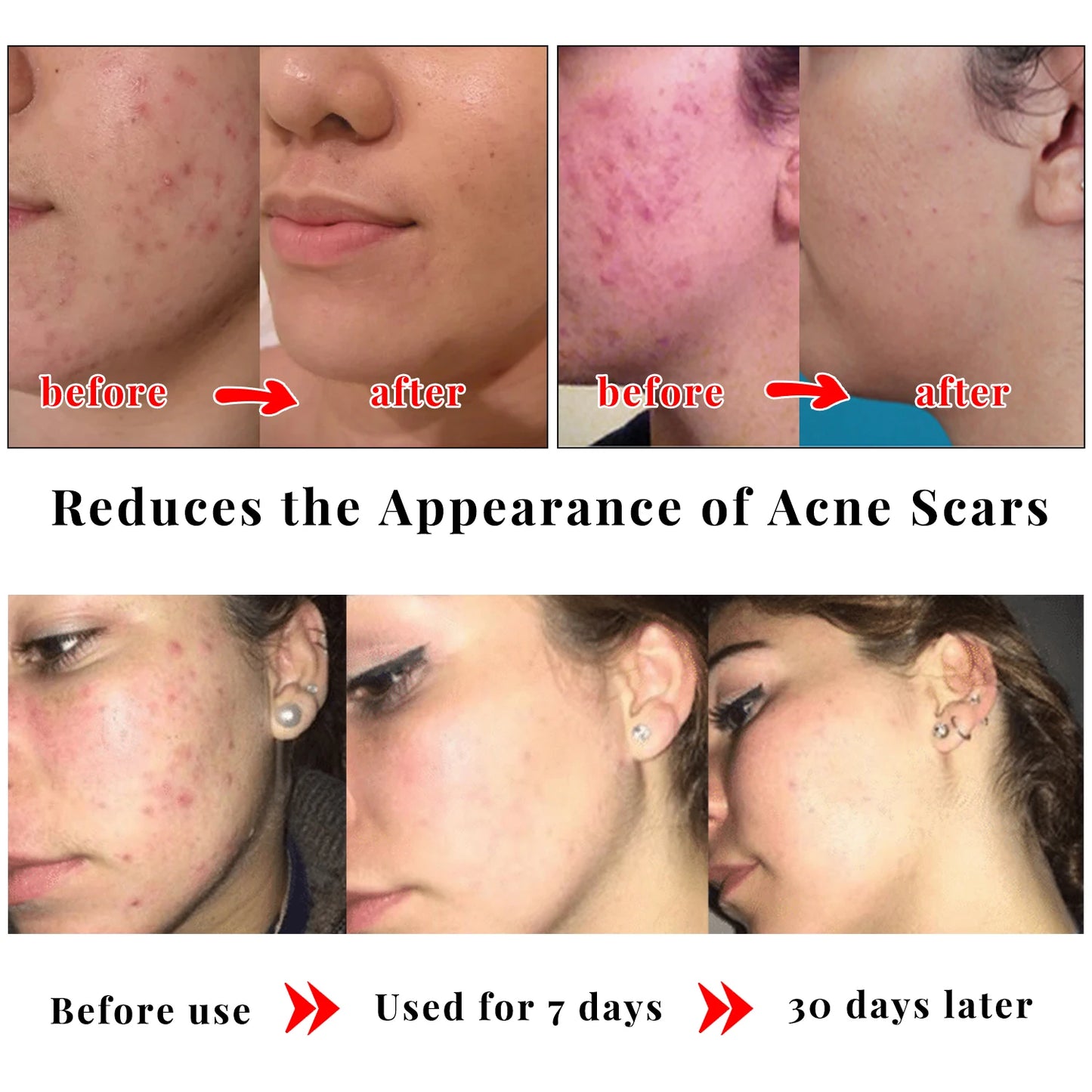 Kojic Acid Skin Care Set