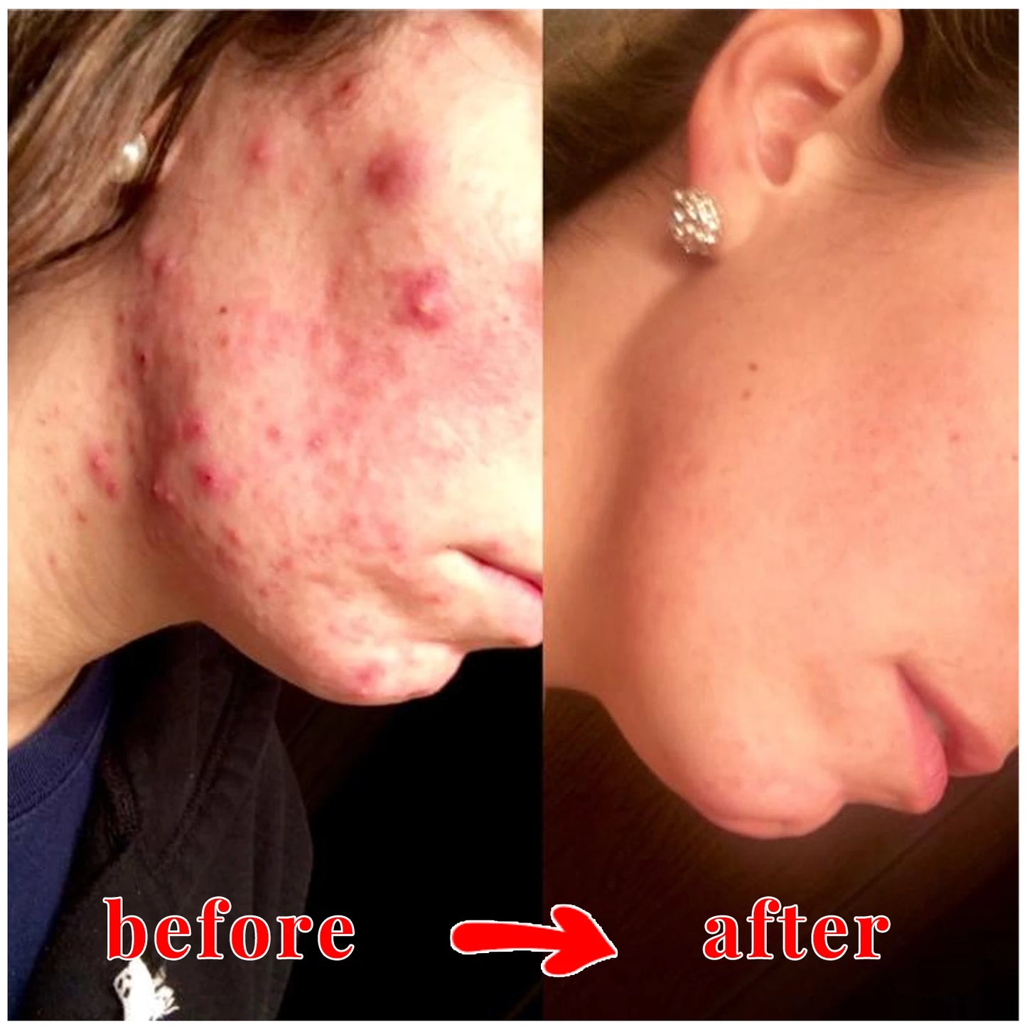 Kojic Acid Skin Care Set