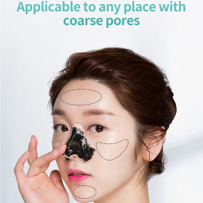 LANBENA Blackhead Remover Mask