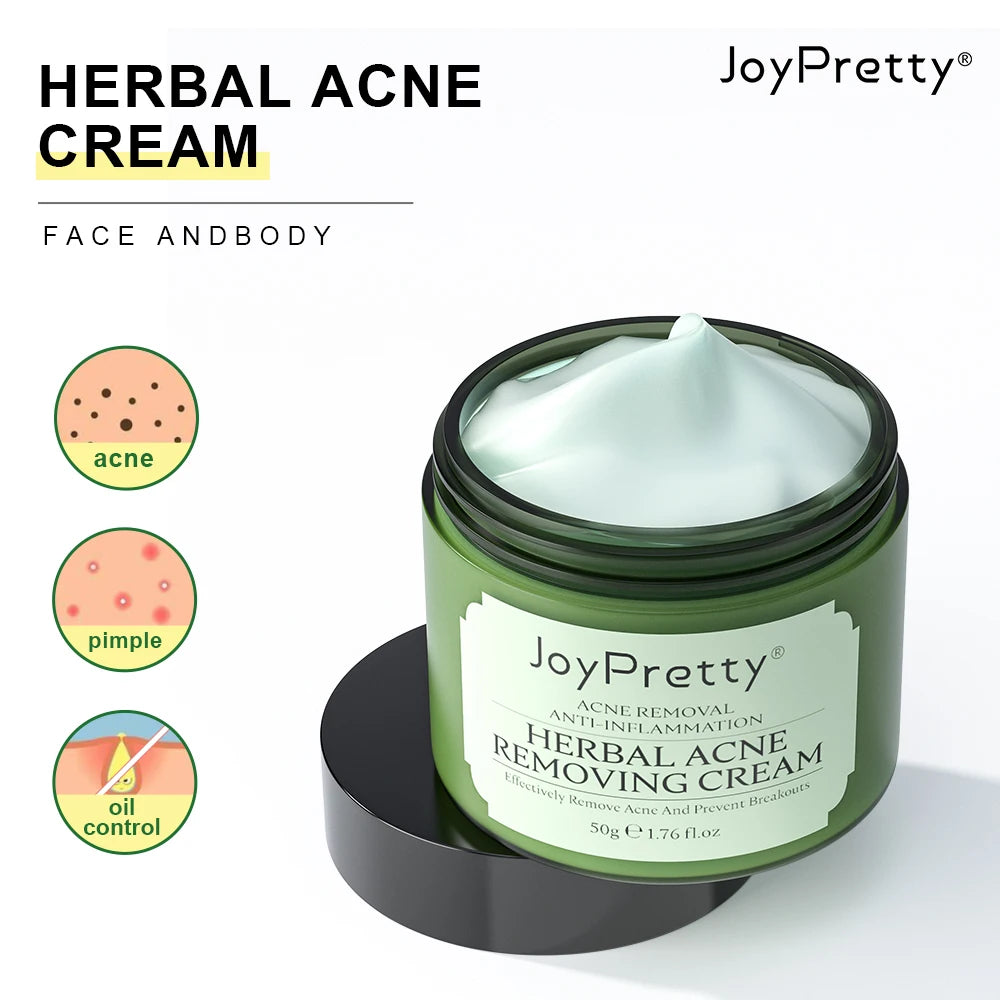 JOYPRETTY Herbal Acne Removing Cream