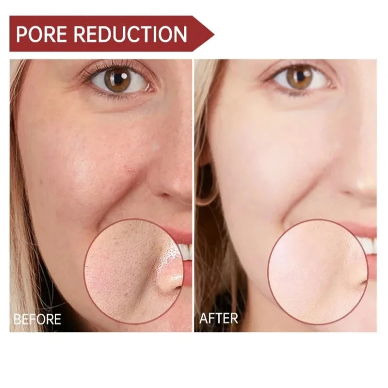 JELLYPRIM Niacinamide Facial Whitening Serum