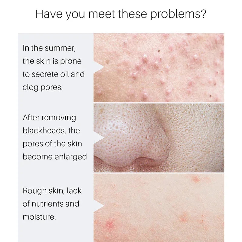 SAUVASINE Pore Control Serum