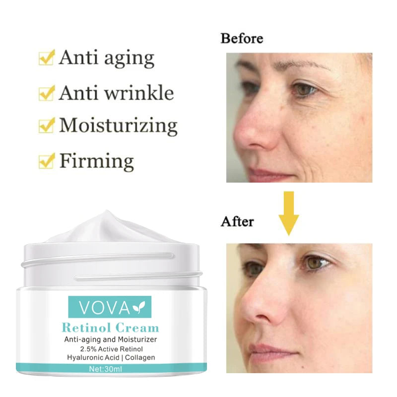 VOVA Anti-Aging Retinol Cream