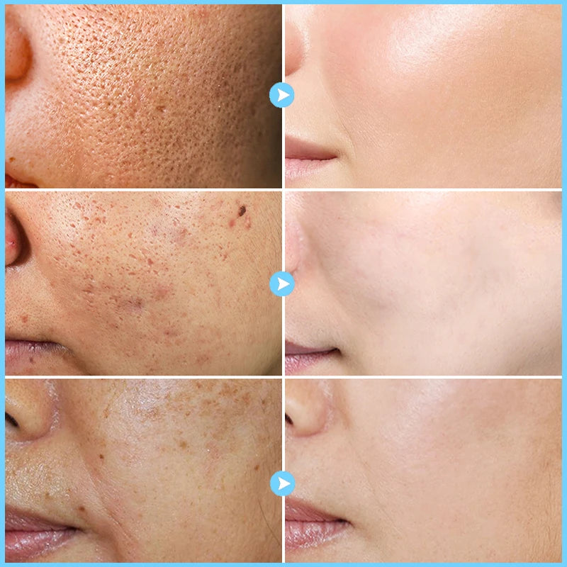 JOYPRETTRY Pore Shrinking Facial Cream