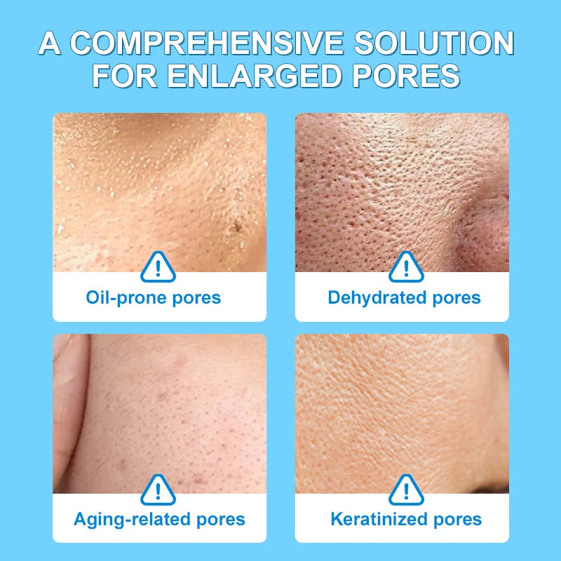 JOYPRETTRY Pore Shrinking Facial Cream
